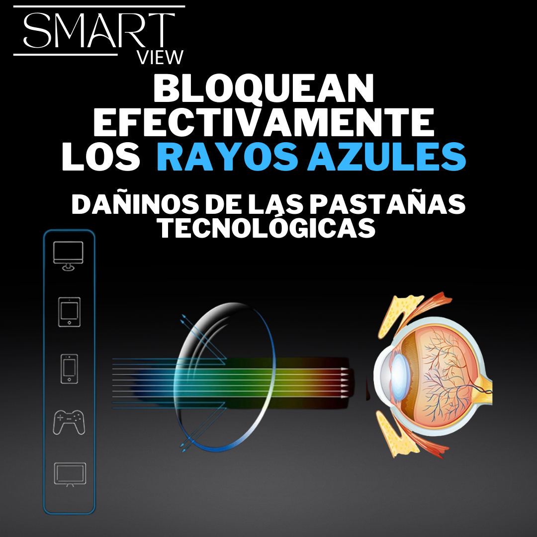 Lentes Ópticos SMART (Visión HD) - PAGA AL RECIBIR 🎁